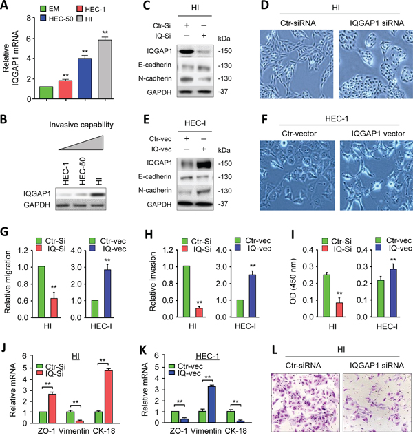 IQGAP1 induces the epithelial-to-mesenchymal transition, invasiveness, and proliferation of endometrial cancer (EC) cells.