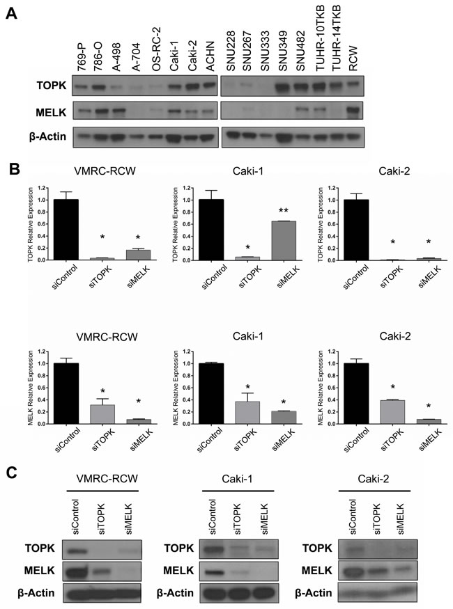 Expression and knockdown effects of TOPK and MELK in kidney cancer cell lines.
