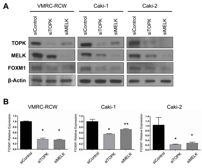 Both TOPK and MELK regulate expression of FOXM1.