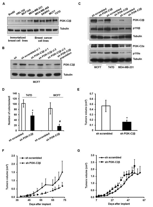 PI3K-C2&#x3b2; is overexpressed in human breast cancer cell lines and plays a critical role in breast cancer cell tumorigenesis.