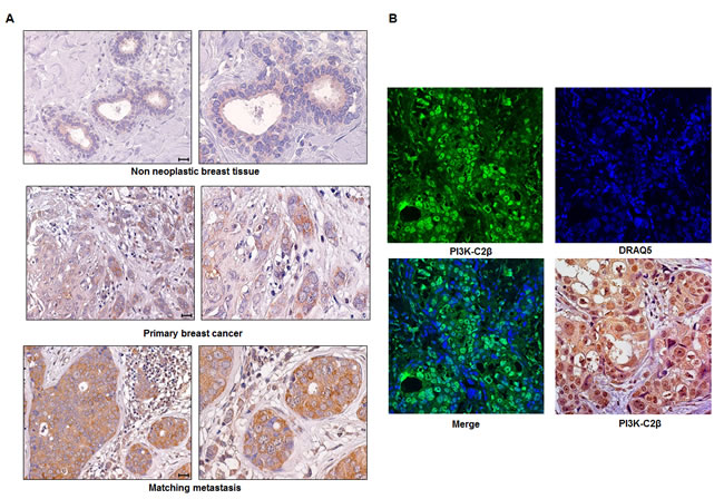 Expression of PI3K-C2&#x3b2; in breast tissues.