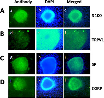 Qualification of DRG and staining of TRPV1, SP, and CGRP in DRG neurons.