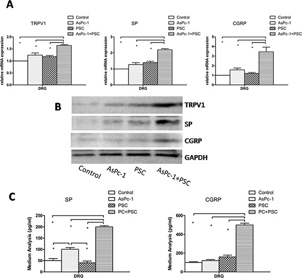 Expression and secretion of TRPV1, SP, and CGRP in DRG.