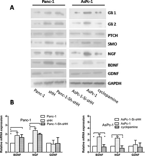 PC cells activate the sHH signaling pathway and increase expression of NGF and BDNF in PSCs.