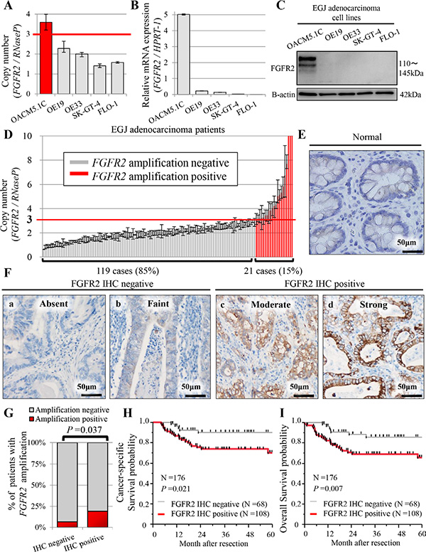 Profiles of FGFR2 status in five human EGJ adenocarcinoma cell lines (A&#x2013;C), and in patients with EGJ adenocarcinoma (N = 176) (D&#x2013;I).