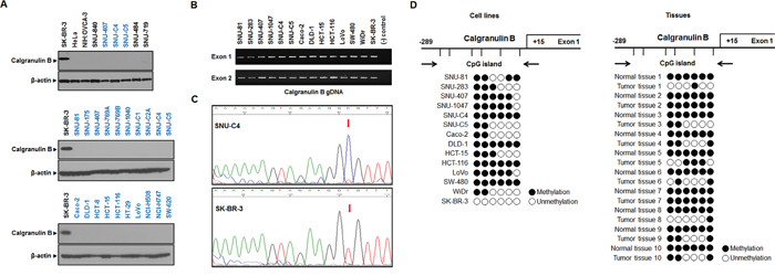 Calgranulin B expression and promoter methylation status in colon cancer cell lines.