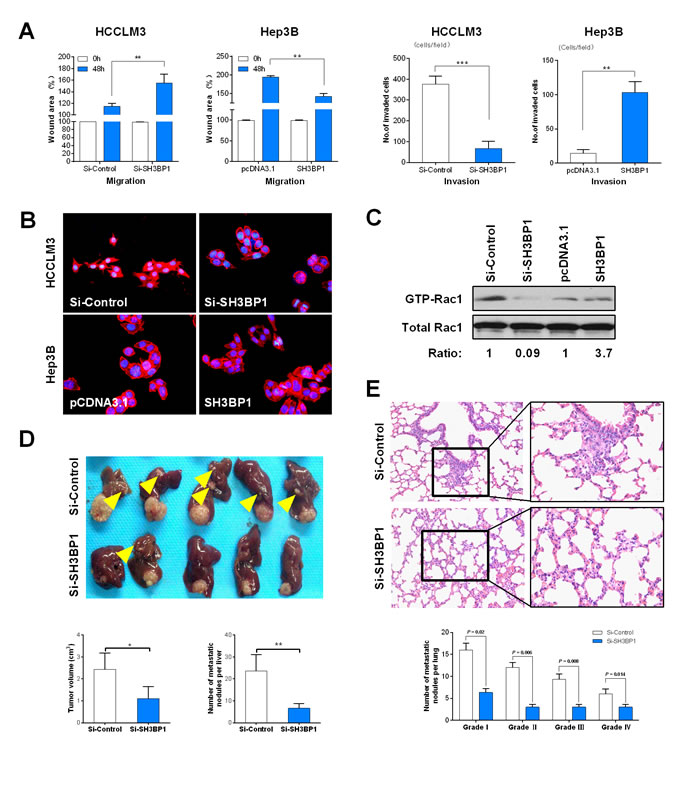 SH3BP1 promotes HCC cell invasion and metastasis