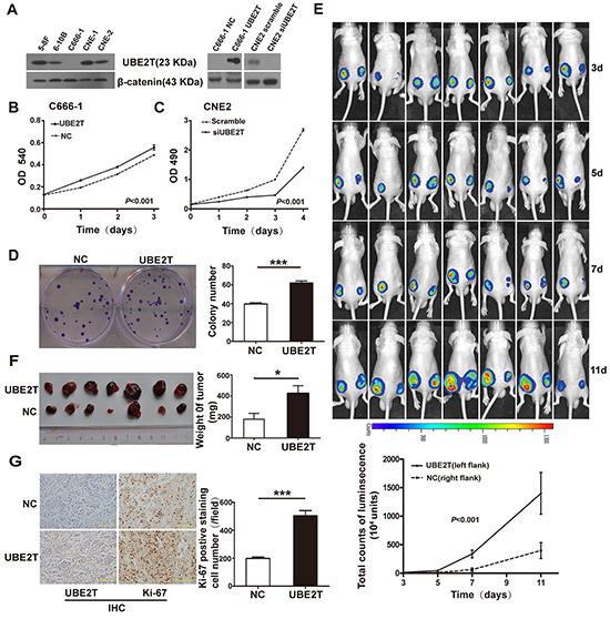 UBE2T promoted NPC cell proliferation in vitro and in vivo.