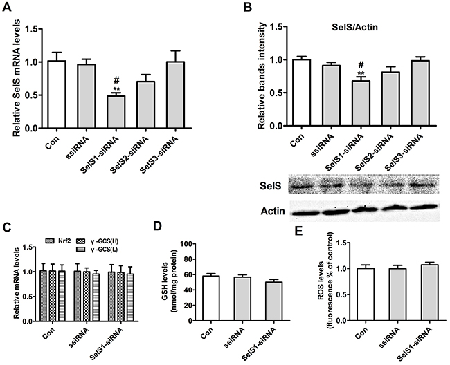 SelS gene expression after transfection of SelS-siRNA into PK15 cells.