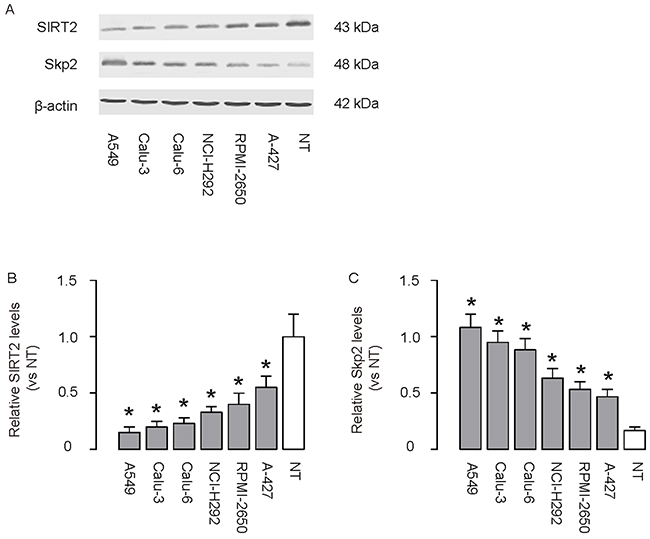 Low SIRT2 and high Skp2 are detected in lung cancer cell lines.
