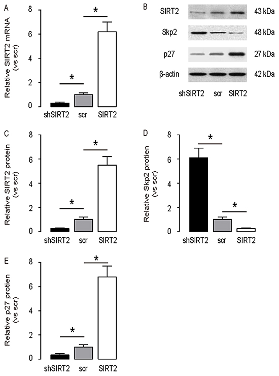 SIRT2 inhibits Skp2 in NSCLC cells.