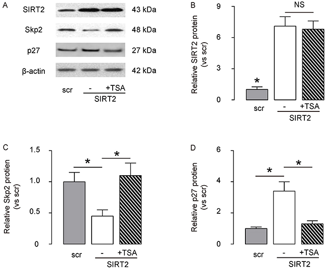 SIRT2 decreases Skp2 levels through induction of Skp2 deacetylation.