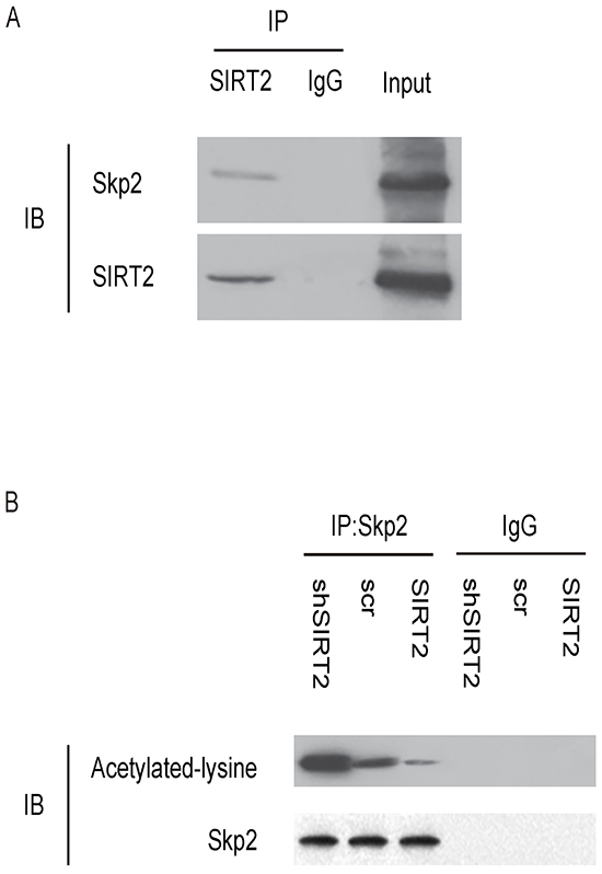 SIRT2 and Skp2 are associated in NSCLC cells.