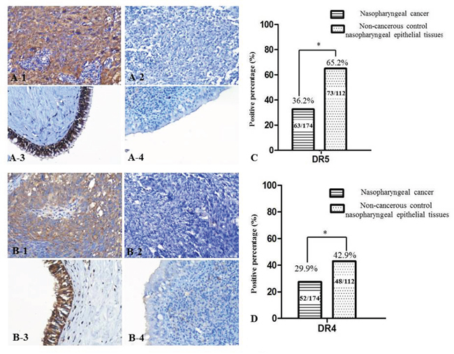 DR5 and DR4 expression decreased in NPC tissues.