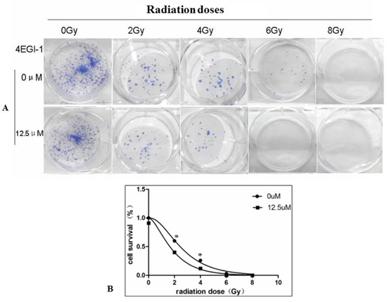 Combined treatment with 4EGI-1 and radiotherapy enhanced radiotherapy sensitivity in NPC cell lines.