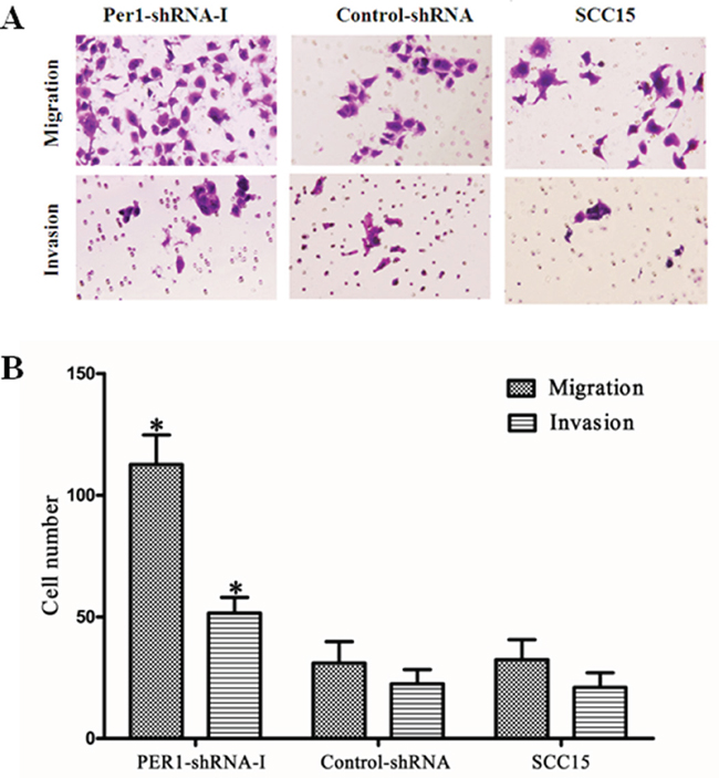 PER1 suppresses cell migration and invasion by SCC15 cells.