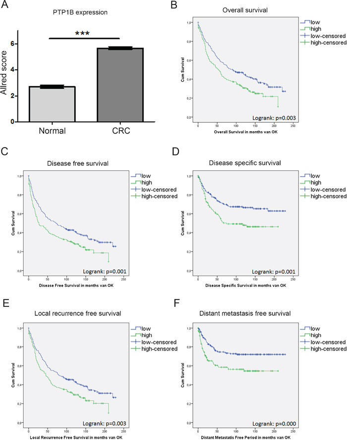 PTP1B expression in a large cohort of CRC patients is correlated to a worse patient survival.