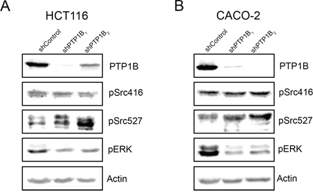 Downregulation of PTP1B interferes with cancer signaling pathways.