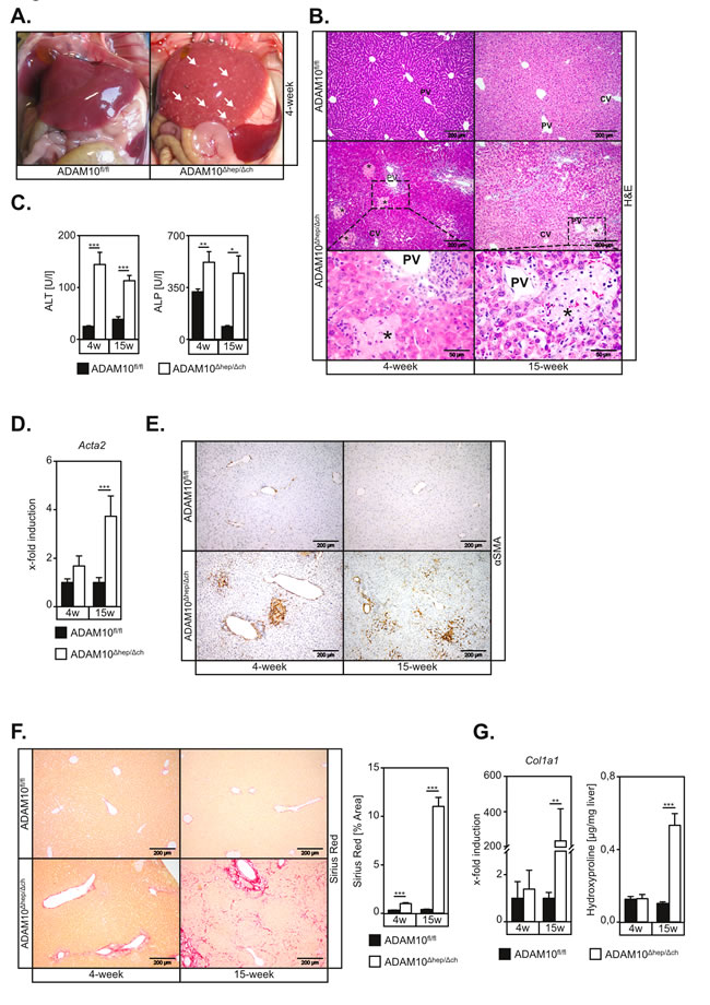 Mice with hepatic deficiency of ADAM10 develop spontaneous hepatocyte necrosis and concomitant liver fibrosis.