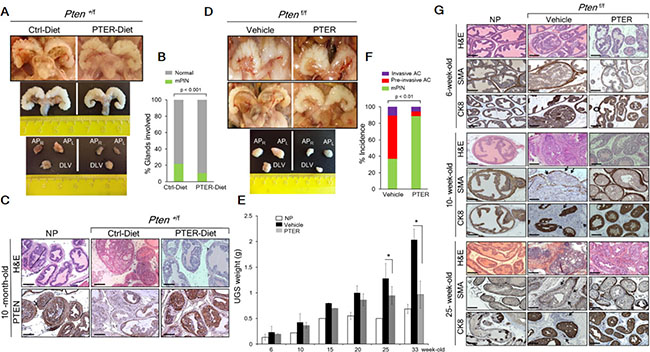 Pterostilbene reduces PIN formation in Pten+/f and blocks progression to adenocarcinoma in Ptenf/f mice.