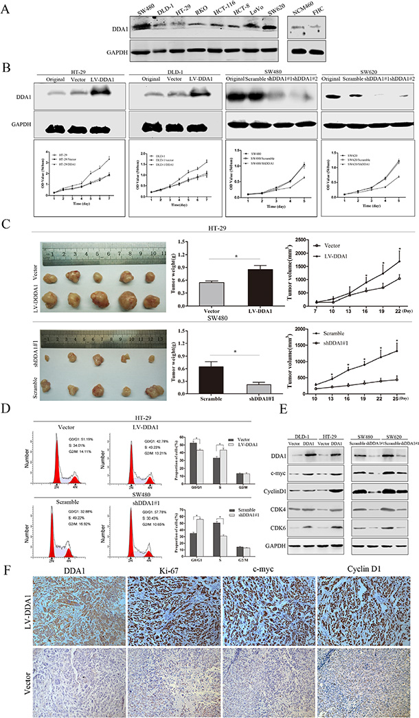 DDA1 facilitates colon cancer cell proliferation and cell cycle progression in vitro and in vivo.