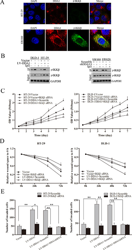 DDA1 activates the NF&#x03BA;B/CSN2/GSK3&#x03B2; pathway by regulating IKK&#x03B2; phosphorylation.