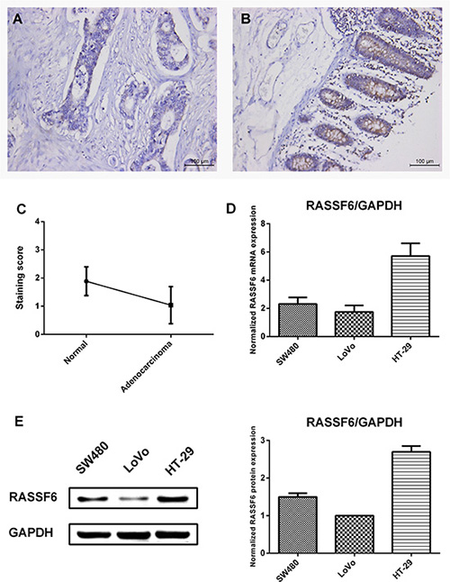 RASSF6 expression in colon tissues and CRC cell lines.