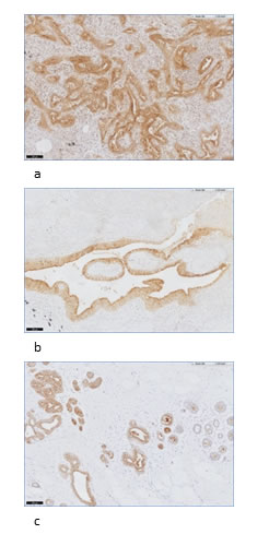 Examples of FR&#x3b1; staining in normal lung and breast tissue.