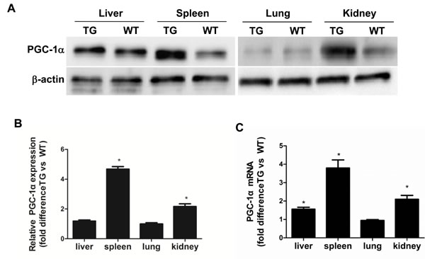 Characterization of PGC-1&#x3b1; transgenic mice.