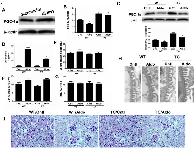 Overexpression of PGC-1&#x3b1; in mice blocked aldosterone-induced podocyte injury.