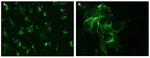 Melatonin expression evaluated by immunofluorescence confocal microscopy (400x) in the pineal gland (A) and thymus (B) of elderly people.