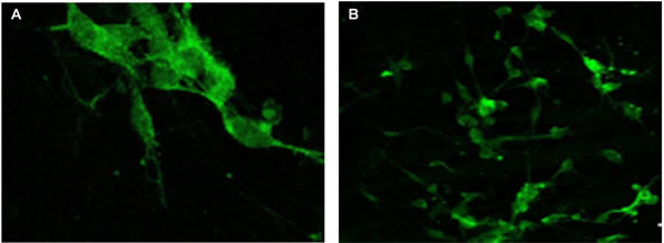 Chromogranin A expression evaluated by immunofluorescence confocal microscopy (400x) in the pineal gland (A) and thymus (B) of elderly people.