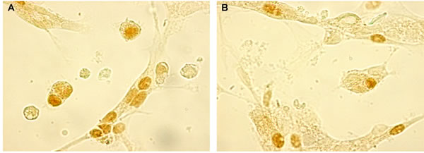 CGRP expression evaluated by immunocytochemistry (200 x) in &#x201c;young&#x201d; pinealocytes (A) and thymocytes (B) culture.