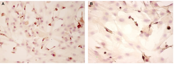 pCREB expression evaluated by immunocytochemistry (200 x) in &#x201c;young&#x201d; pinealocytes (A) and thymocytes (B) culture.