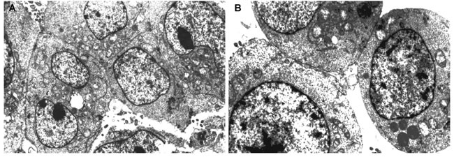The ultrastructure of pinealocytes and thymic epithelial cells of elderly people evaluated by electron microscopy (1000&#x445;) in ultra-thin slices contrasted with uranyl acetate and lead citrate.