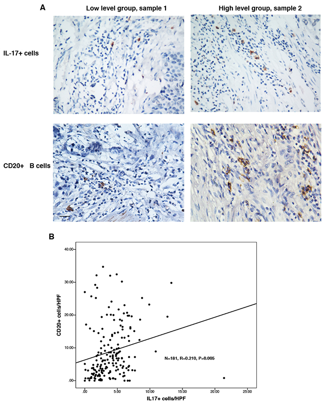 There was positive relationship between the counts of CD20+ B cells and IL-17-producing cells.