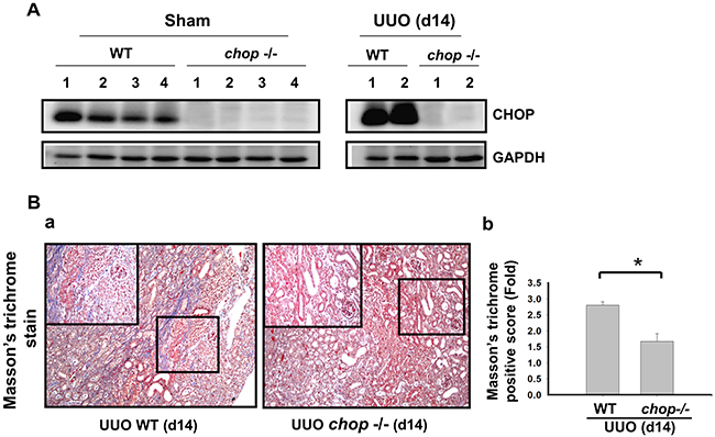 CHOP deficiency alleviates UUO-induced collagen deposition in fibrotic kidney.