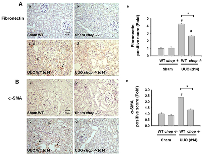 CHOP deficiency mitigates UUO-induced FN and &#x03B1;-SMA expression.