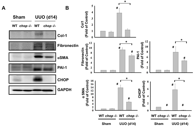 CHOP deficiency attenuates fibrosis-related markers in the kidneys of UUO mice.