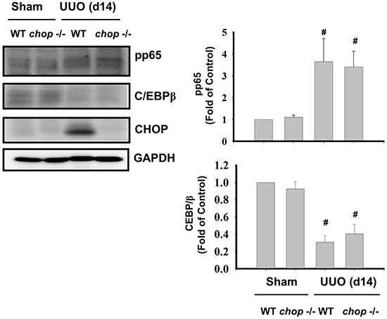 CHOP deficiency does not activate NF&#x03BA;B-p65 phosphorylation and C/EBP&#x03B2; expression in the kidneys of UUO rats.