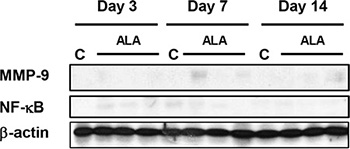 Western blotting was performed using anti-MMP-9 and anti-phosphorylated NF-&#x03BA;B antibodies.