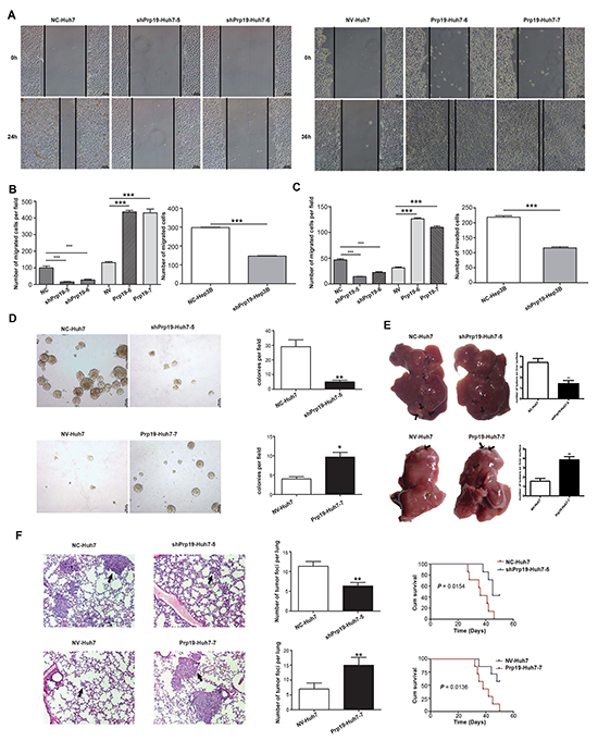 Prp19 enhances invasive potentials of HCC cells both in vitro and in vivo.