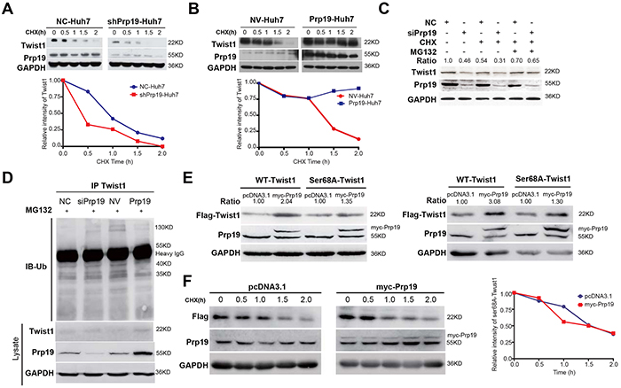 Prp19 inhibits the ubiquitin/proteasome-dependent degradation of Twist1 in HCC cells.