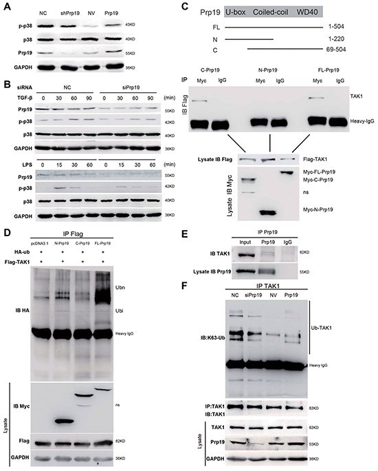 Prp19 facilitates k63-linked polyubiquitination on TAK1 to activate p38 MAPK in HCC cells.