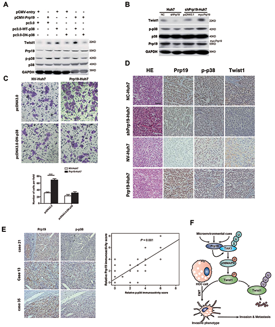 Prp19 mediates invasion of HCC via p38 MAPK/Twist1 pathway.