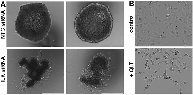 Reduced ILK modulates MCA formation and cell spreading.