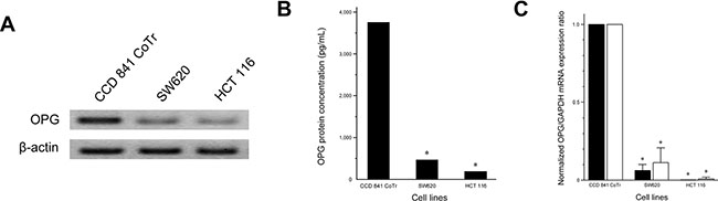 OPG expression in human normal colonic epithelial (CCD 841 CoTr) and CRC (SW620 and HCT 116) cell lines.