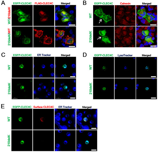 The ALS-associated CLEC4C mutant is deficient in surface expression.