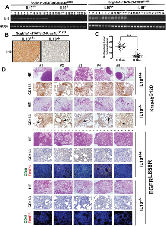 IL10-deficent mice failed to develop lung cancer induced by Kras4bG12D and EGFRL858R.