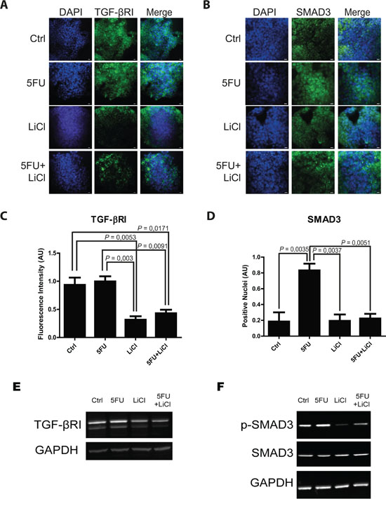 5-fluorouracil treatment causes an activation of TGF-&#x03B2; pathway in the in vitro 3D-cultured chemoresistant cells.